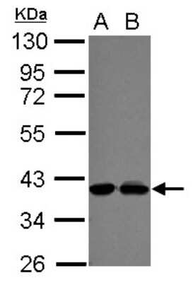 Western Blot: SKAR Antibody [NBP2-20378]