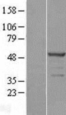 Western Blot: SKAR Overexpression Lysate [NBL1-14570]