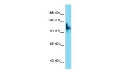 Western Blot: SKIDA1 Antibody [NBP2-85733]