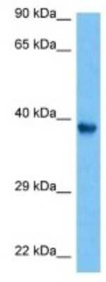 Western Blot: SKINT9 Antibody [NBP3-10222]