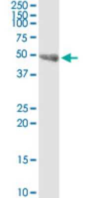 Western Blot: SKIP Antibody (3B4) [H00051763-M09]