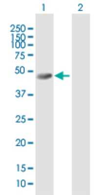 Western Blot: SKIP Antibody [H00051763-B01P]