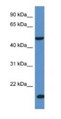 Western Blot: SKIP Antibody [NBP1-74128]