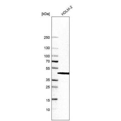 Western Blot: SKIP Antibody [NBP1-87034]