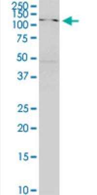 Western Blot: SKIV2L Antibody (1E5) [H00006499-M05-50ug]
