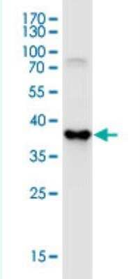 Western Blot: SKIV2L Antibody (1E5) [H00006499-M05-50ug]