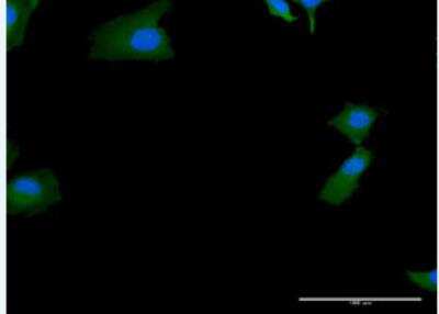Immunocytochemistry/ Immunofluorescence: SKIV2L Antibody [H00006499-B01P-50ug]