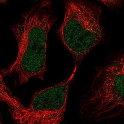 Immunocytochemistry/ Immunofluorescence: SKIV2L Antibody [NBP2-47274]