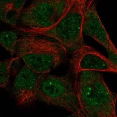 Immunocytochemistry/ Immunofluorescence: SKIV2L Antibody [NBP3-17769]