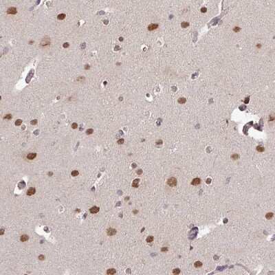 Immunohistochemistry-Paraffin: SKIV2L Antibody [NBP2-47274]