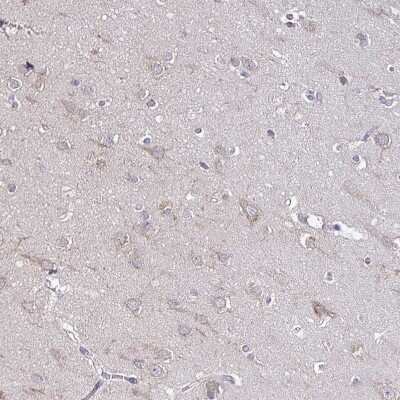 Immunohistochemistry-Paraffin: SKIV2L Antibody [NBP2-47275]