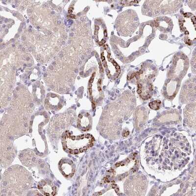 Immunohistochemistry-Paraffin: SKIV2L Antibody [NBP2-47275]