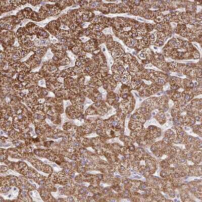 Immunohistochemistry-Paraffin: SKIV2L Antibody [NBP2-47275]