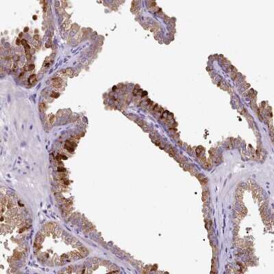 Immunohistochemistry-Paraffin: SKIV2L Antibody [NBP2-47275]