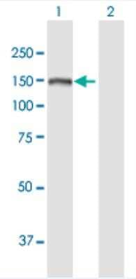 Western Blot: SKIV2L Antibody [H00006499-B01P-50ug]