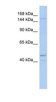 Western Blot: SKIV2L Antibody [NBP1-57119]