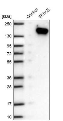 Western Blot: SKIV2L Antibody [NBP2-47274]