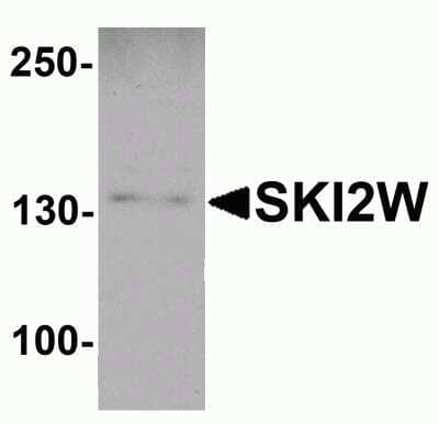 Western Blot: SKIV2L AntibodyBSA Free [NBP2-81903]