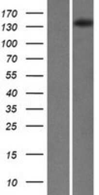 Western Blot: SKIV2L Overexpression Lysate [NBP2-07555]