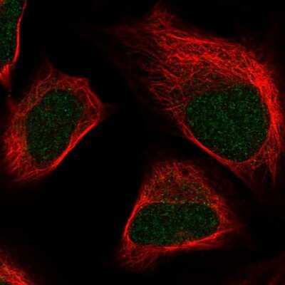 Immunocytochemistry/ Immunofluorescence: SKIV2L2 Antibody [NBP1-84995]