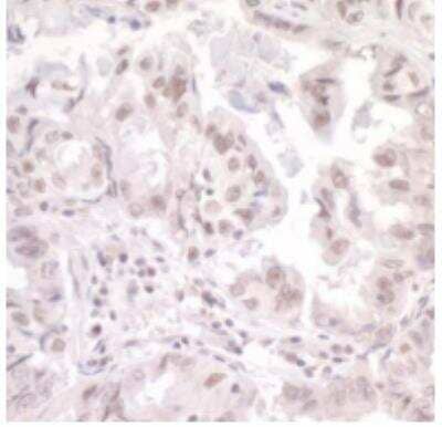 Immunohistochemistry-Paraffin: SKIV2L2 Antibody [NB100-1574]