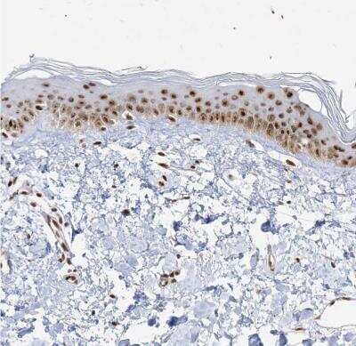 Immunohistochemistry-Paraffin: SKIV2L2 Antibody [NBP1-84995]