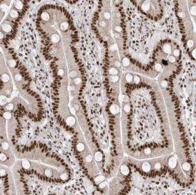 Immunohistochemistry-Paraffin: SKIV2L2 Antibody [NBP1-84995]