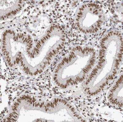 Immunohistochemistry-Paraffin: SKIV2L2 Antibody [NBP1-84995]