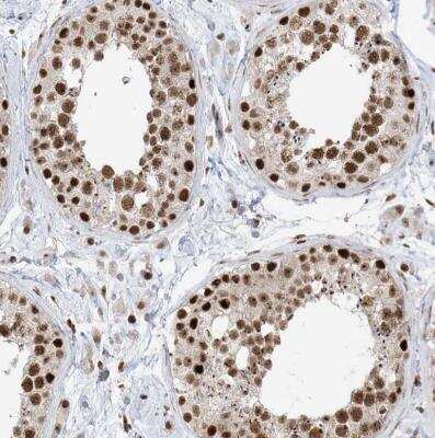 Immunohistochemistry-Paraffin: SKIV2L2 Antibody [NBP1-84995]