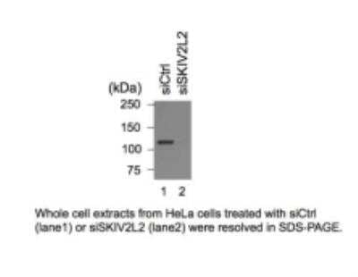 Western Blot: SKIV2L2 Antibody [NB100-1574]