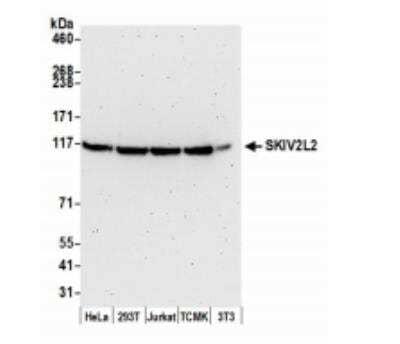 Western Blot: SKIV2L2 Antibody [NB100-1574]