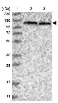 Western Blot: SKIV2L2 Antibody [NBP1-84995]