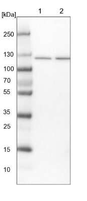 Western Blot: SKIV2L2 Antibody [NBP1-84995]