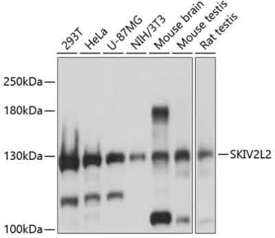 Western Blot: SKIV2L2 AntibodyBSA Free [NBP2-93932]