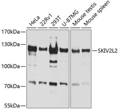 Western Blot: SKIV2L2 AntibodyBSA Free [NBP2-94315]