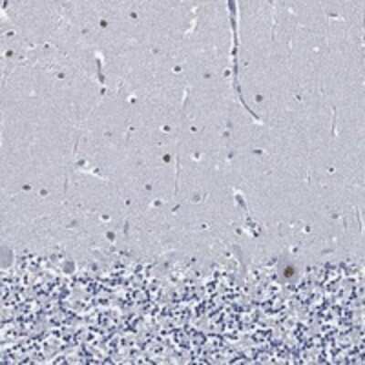 Immunohistochemistry-Paraffin: SKOR1 Antibody [NBP3-17538]