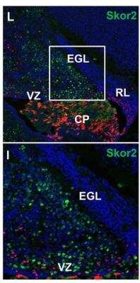 Immunocytochemistry/ Immunofluorescence: SKOR2 Antibody [NBP2-14565]