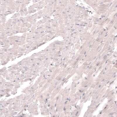 Immunohistochemistry-Paraffin: SKOR2 Antibody [NBP2-14565]