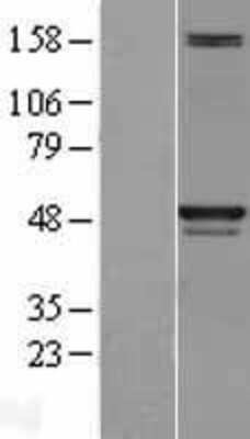 Western Blot: Skp2 Overexpression Lysate [NBL1-15995]