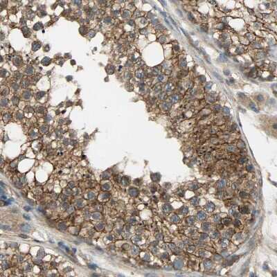 Immunohistochemistry-Paraffin: SKT Antibody [NBP1-84100]