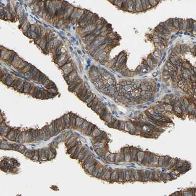 Immunohistochemistry-Paraffin: SKT Antibody [NBP1-84100]