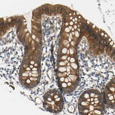 Immunohistochemistry-Paraffin: SKT Antibody [NBP1-84100]