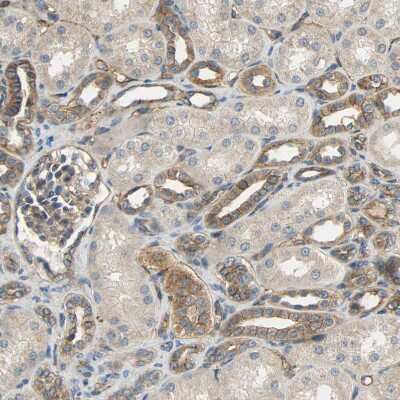 Immunohistochemistry-Paraffin: SKT Antibody [NBP1-84100]