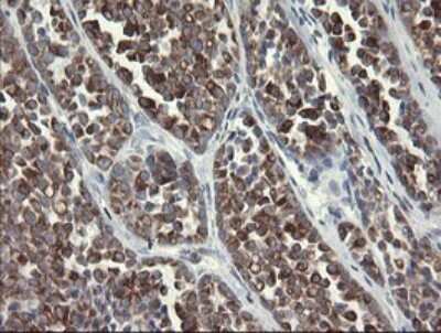 Immunohistochemistry: SLA2 Antibody (OTI3A7) [NBP2-45867]