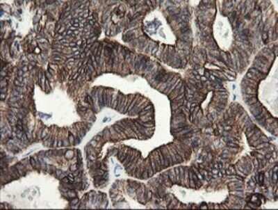 Immunohistochemistry: SLA2 Antibody (OTI3A7) [NBP2-45867]