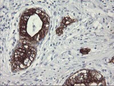Immunohistochemistry: SLA2 Antibody (OTI3A7) [NBP2-45867]