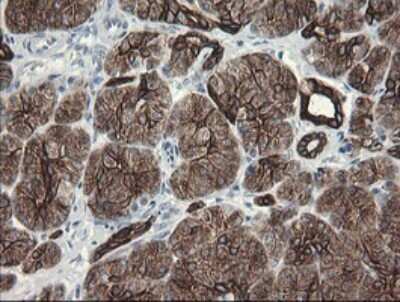 Immunohistochemistry: SLA2 Antibody (OTI3A7) [NBP2-45867]