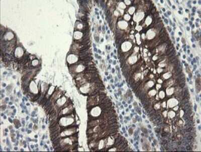 Immunohistochemistry: SLA2 Antibody (OTI3A7) [NBP2-45867]