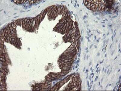 Immunohistochemistry: SLA2 Antibody (OTI3A7) [NBP2-45867]
