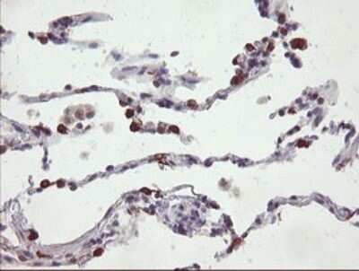 Immunohistochemistry: SLA2 Antibody (OTI3A7) [NBP2-45867]
